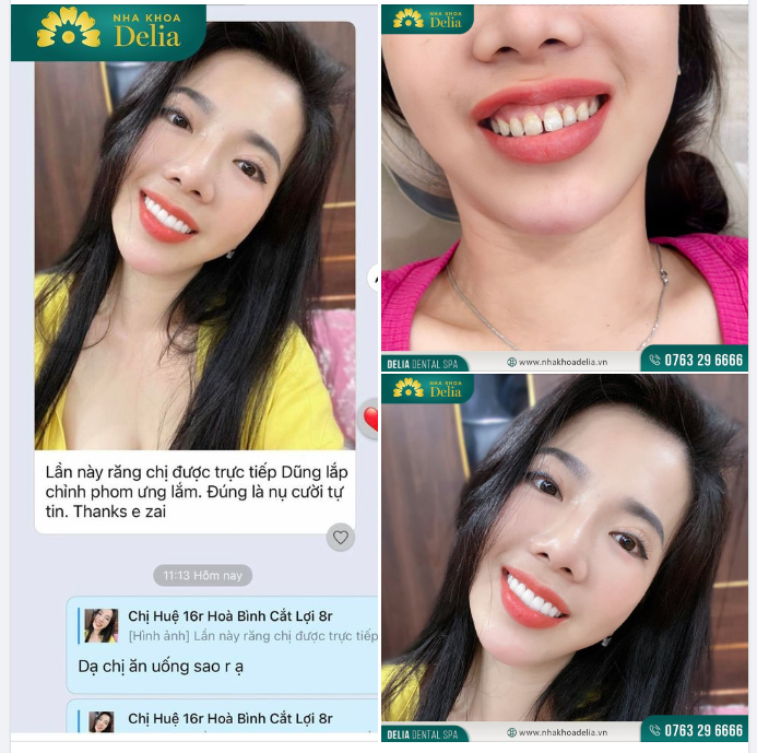 Với nụ cười mới, Delia chúc chị Huệ luôn giữ thần thái tươi tắn, tự tin lạc quan trong cuộc sống.