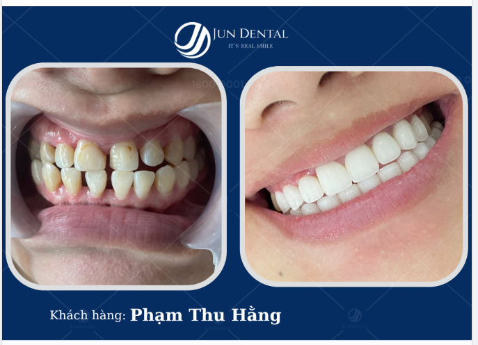 Giờ ngày nào chị cũng soi gương, chị không nhận ra mình nữa, khác quá em ạ!
