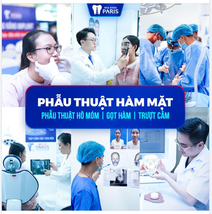 Những hình ảnh thực tế của khách hàng Phẫu thuật Hàm mặt tại Nha khoa Paris