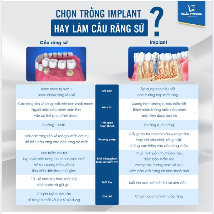 TOP 3 cách phục hình răng bị mất phổ biến nhất hiện nay