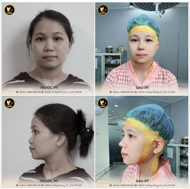 MỘT GƯƠNG MẶT – HAI NHAN SẮC