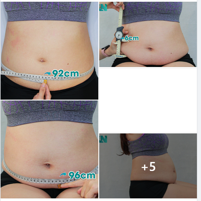 CHỊ KH 36 TUỔI – SAU 3 LẦN SINH, ĐƯỢC ÔNG XÃ ỦNG HỘ GIẢM MỠ.