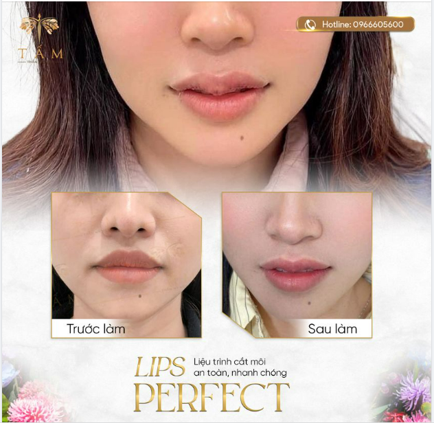 HỌA DÁNG MÔI XINH - LUNG LINH ĐÓN TẾT