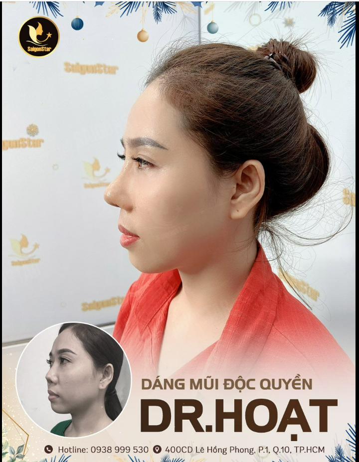DÁNG MŨI ĐỘC QUYỀN DR. HOẠT THIẾT CÁ DÁNG MŨI MANG DẤU ẤN CÁ NHÂN