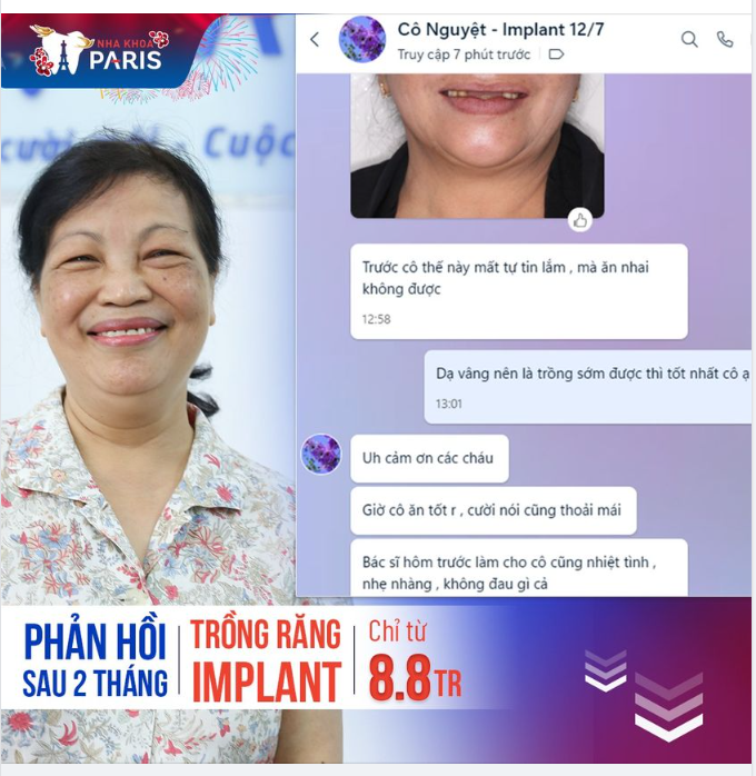 PHẢN HỒI SAU 2 THÁNG TRỒNG RĂNG IMPLANT