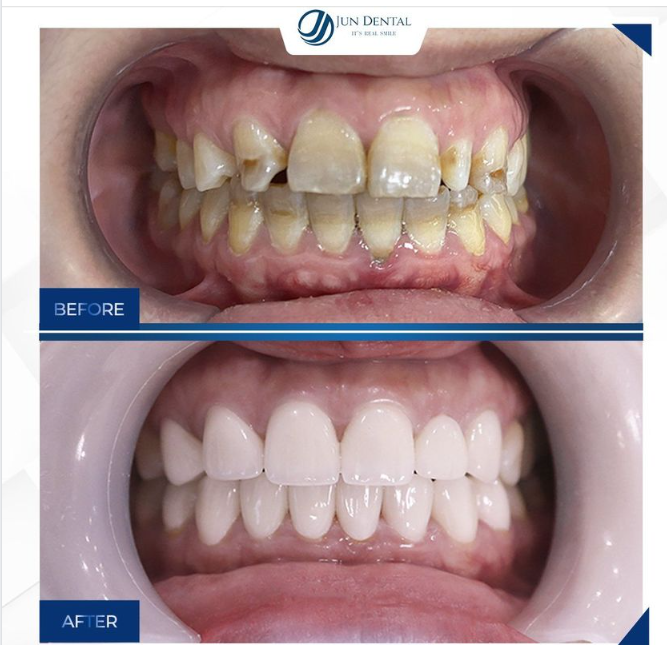 HOÀN HẢO VÀ TÂM HUYẾT LÀ 2 MĨ TỪ MÀ KHÁCH HÀNG DÀNH TẶNG JUN DENTAL