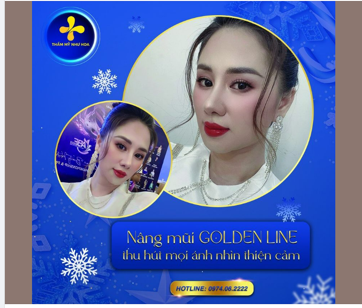 NÂNG MŨI GOLDEN LINE THU HÚT MỌI ÁNH NHÌN THIỆN CẢM