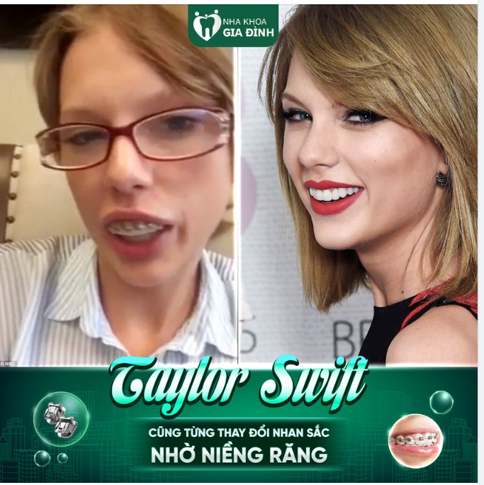Niềng răng thật thần kỳ.