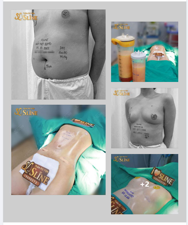 XÃ HỘI ngày càng hiện đại. Ngành thẩm mỹ luôn được cải tiến và phát triển khiến ai cũng có nhu cầu làm đẹp dù là nam hay nữ.
