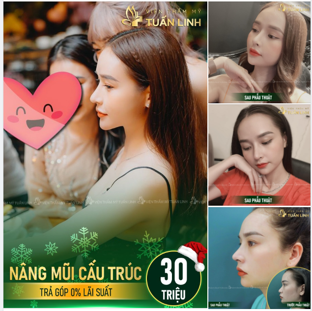 Dừng lại một chút thôi nếu bạn đang muốn "THAY ĐỔI DÁNG MŨI - NÂNG TẦM NHAN SẮC"!