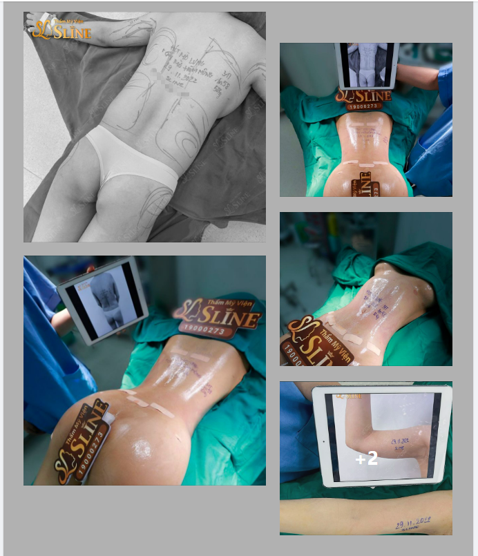 Khi ca phẫu thuật trở thành “tác phẩm nghệ thuật” từ bàn tay của các bác sĩ ekip Sline.