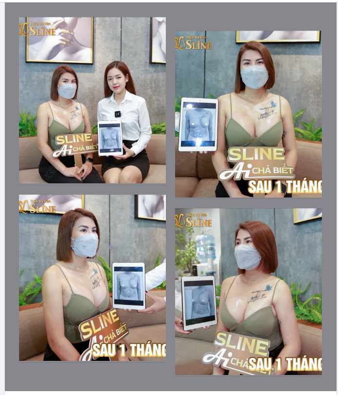 Kiến tạo vòng 1 đẹp chuẩn mọi góc nhìn.