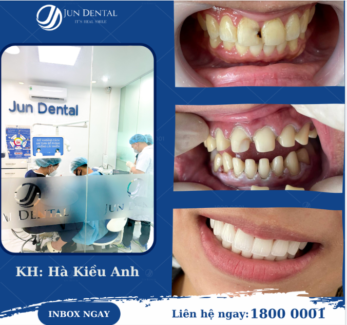 Chúc chị Hà Kiều Anh luôn gặt hái được nhiều may mắn và thành công từ nụ cười mới!