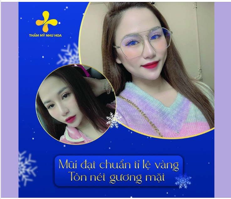 Nâng mũi Golden Line đã biến đổi nhan sắc khách hàng thế nào?