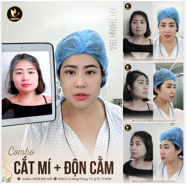 COMBO CẮT MÍ + ĐỘN CẰM ĐẸP TRỌN SẮC XUÂN