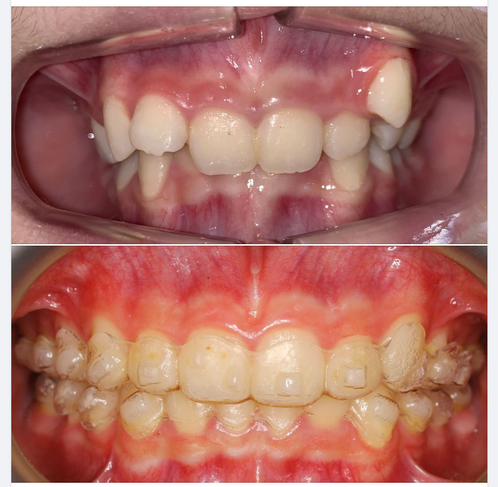 Trăm ngàn lời nói quảng cáo, không bằng hình ảnh từ ca thực tế!