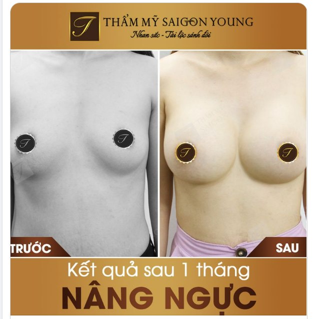VÒNG 1 sau 1 tháng NÂNG CẤP