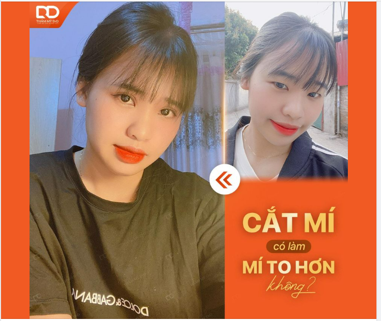 CẮT MÍ CÓ LÀM MẮT TO HƠN KHÔNG?