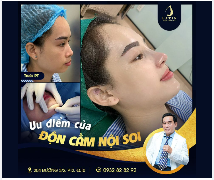 ƯU ĐIỂM ĐỘN CẰM NỘI SOI TẠI LATIN