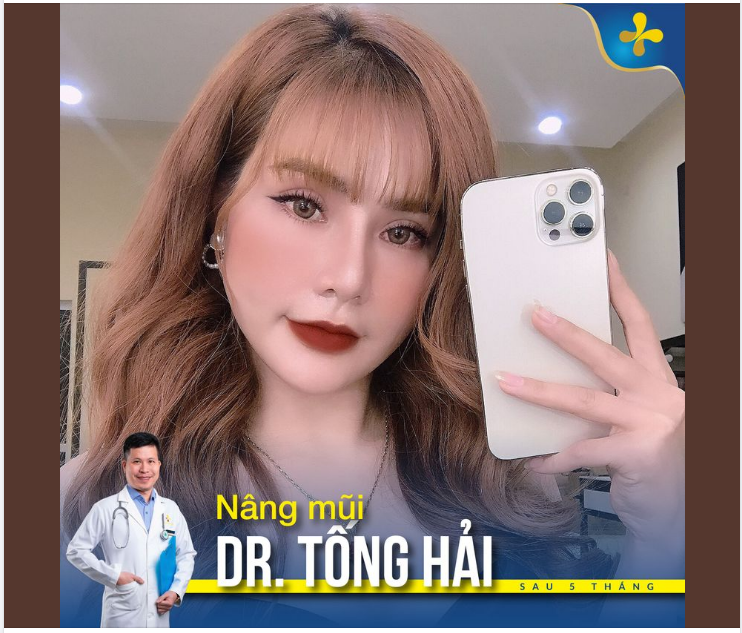 Nàng chưa ưng dáng mũi hiện tại của mình?
