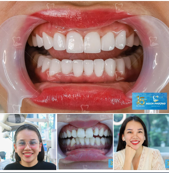 Chúc mừng chị Kim Chi đã có được nụ cười như ý