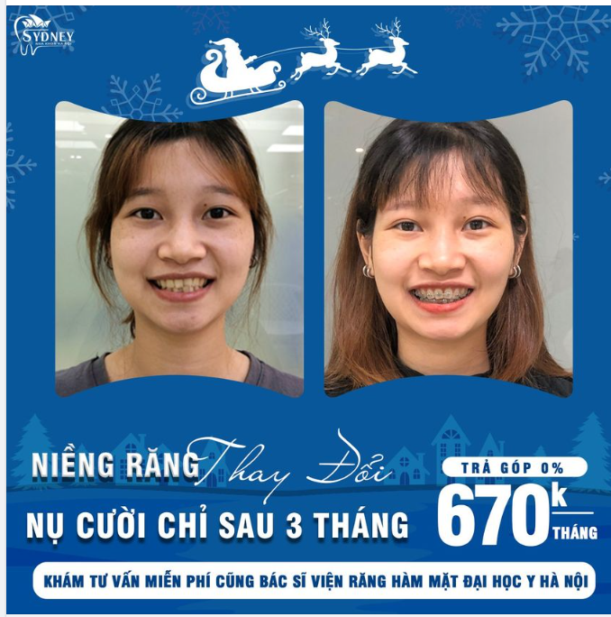 Chọn mặt gửi vàng – Chọn Nha khoa Hà Nội Sydney để gửi gắm nụ cười xinh
