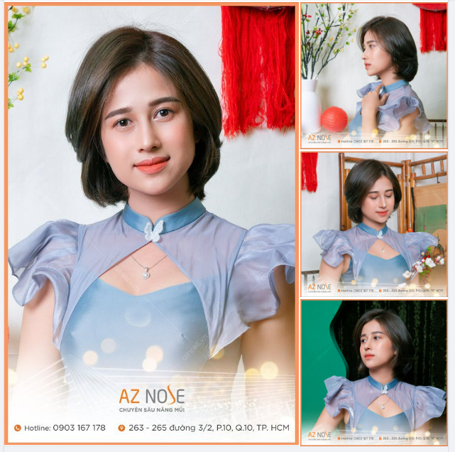 Cô nàng Trà Vinh đẹp dịu dàng sau 6 tháng nâng mũi