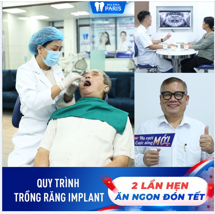 CHỈ 2 LẦN HẸN CÓ NGAY RĂNG IMPLANT MỚI