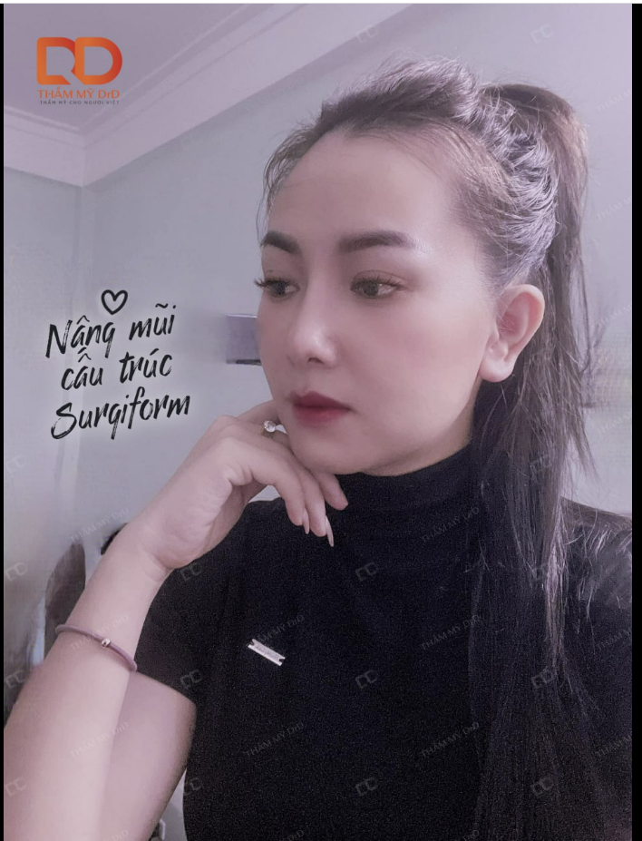 Nâng mũi cấu trúc để chỉnh sửa toàn diện các khuyết điểm và tạo dáng mũi hoàn hảo nhất, đặc biệt phù hợp với các tình trạng: