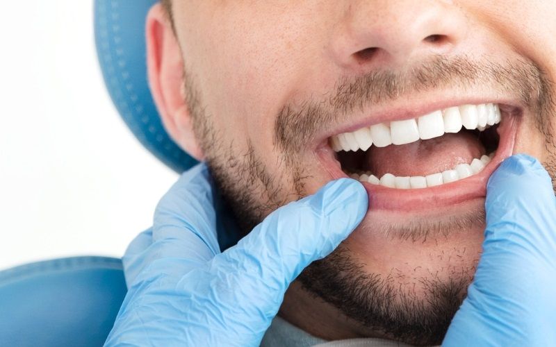 Cả hai kỹ thuật chỉnh nha đều giúp răng dịch chuyển về đúng vị trí trên cung hàm