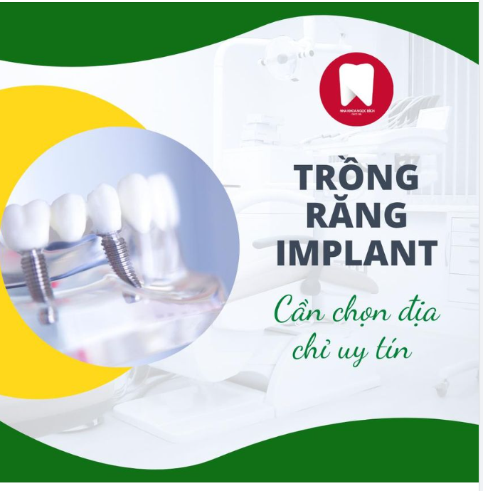 TRỒNG RĂNG IMPLANT - ĐỪNG HAM GIÁ RẺ, COI CHỪNG RƯỚC HỌA