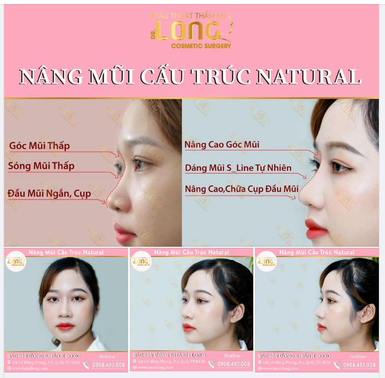 NẾU BÂY GIỜ KHÔNG NÂNG MŨI BẠN SẼ HỐI TIẾC 3 ĐIỀU NÀY
