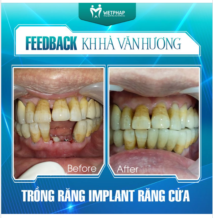 ĐỐI VỚI MỌI NGƯỜI, NỤ CƯỜI CÓ Ý NGHĨA NHƯ THẾ NÀO?