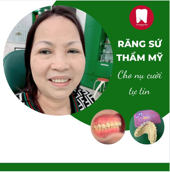 THẨM MỸ RĂNG SỨ, BẠN ĐƯỢC GÌ?