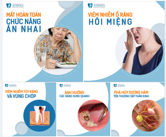 MẤT RĂNG RĂNG SÂU VỠ CÒN CHÂN RĂNG NHỮNG TÁC HẠI BẠN KHÔNG NGỜ ĐẾN!!!
