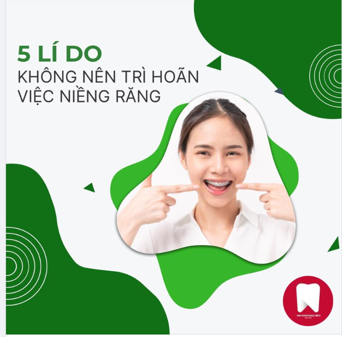5 Lý do bạn nên niềng răng ngay mà không nên trì hoãn