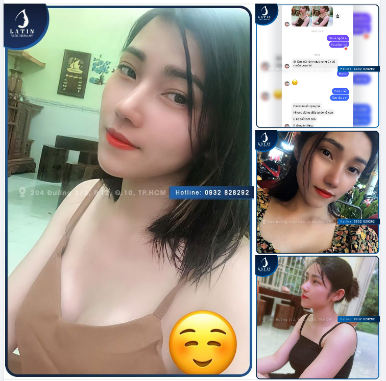 Chưa kịp làm mũi thì chồng đòi ly dị. Giờ làm xong rồi thì chồng cũ đòi quay lại. Là các chị thì các chị tính sao ạ?