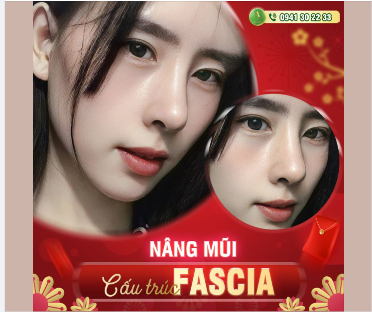 MŨI XINH - LUNG LINH ĐÓN TẾT