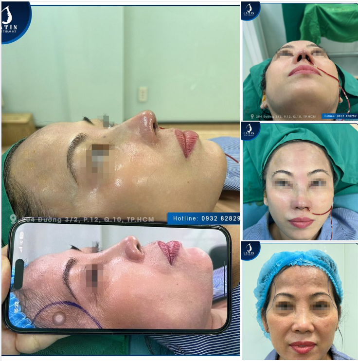 Tân trang nhan sắc đón Tết cùng chị khách quận 2