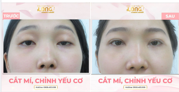 THAY ĐỔI NHỎ TẠO NÊN SẮC DIỆN MỚI