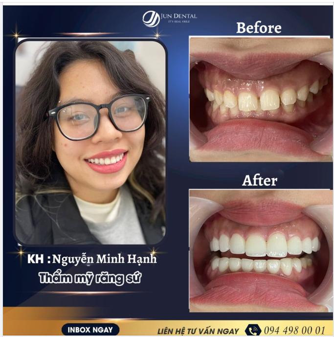 ĐẾN JUN DENTAL PHÁ BỎ LỜI NGUYỀN "CHỤP ẢNH KHÔNG BAO GIỜ ĐẸP" ĐỂ ĐÓN TẾT
