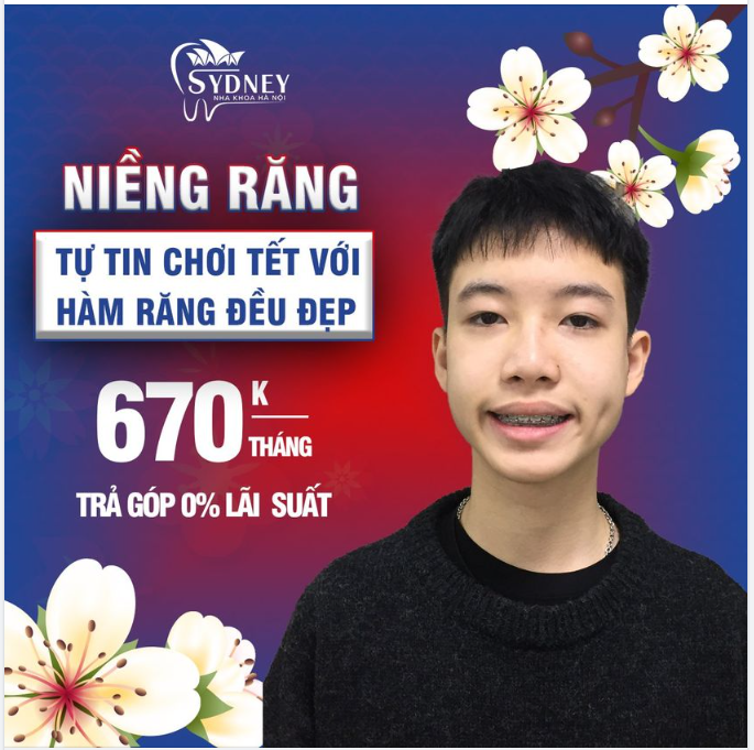 Niềng răng tìm lại nụ cười – Tết này vô cùng tự tin