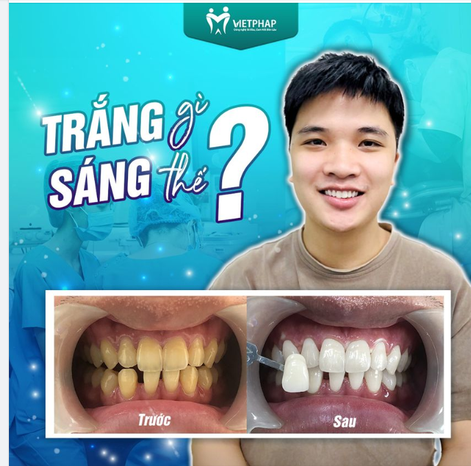 TRẮNG GÌ MÀ SÁNG THẾ?