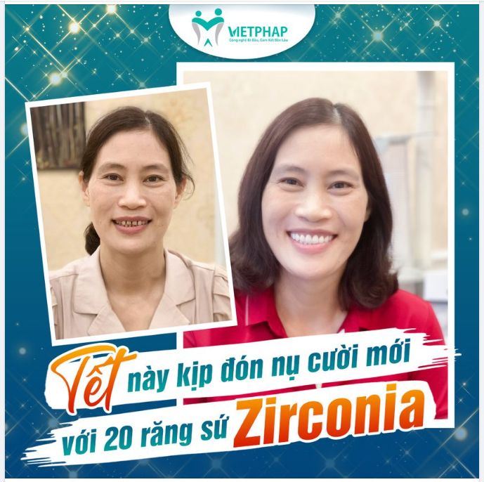 TẾT NÀY KỊP ĐÓN NỤ CƯỜI MỚI VỚI 20 RĂNG SỨ ZIRCONIA