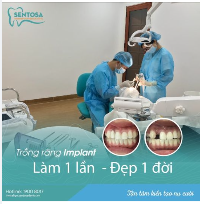 TRỒNG RĂNG IMPLANT- LÀM MỘT LẦN ĐẸP MỘT ĐỜI