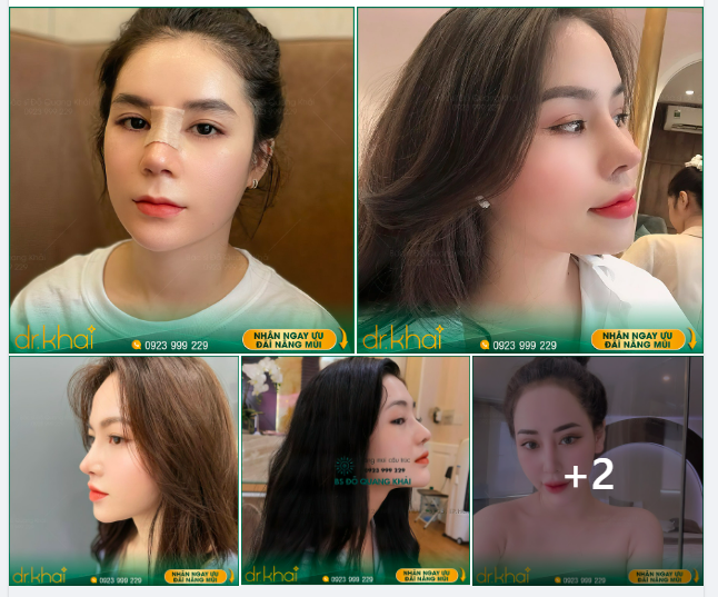 MŨI CAO TÂY TỰ NHIÊN - BẮT TRỌN MỌI GÓC ẢNH THẦN THÁI.