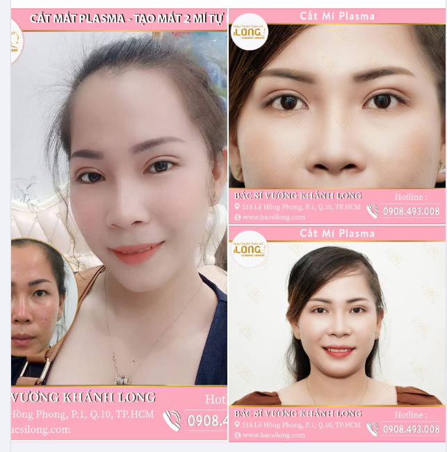 THIỆN CẢM GIẢM ƯU PHIỀN LÀ CÓ THẬT NHA CẢ NHÀ ƠI!