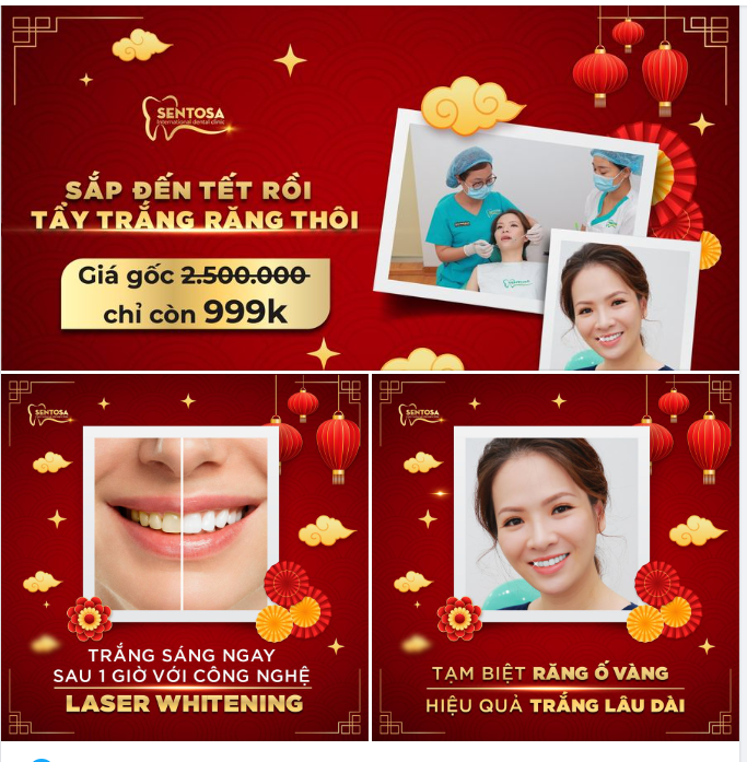 TẨY TRẮNG RĂNG ĐÓN TẾT ​​​​​​​