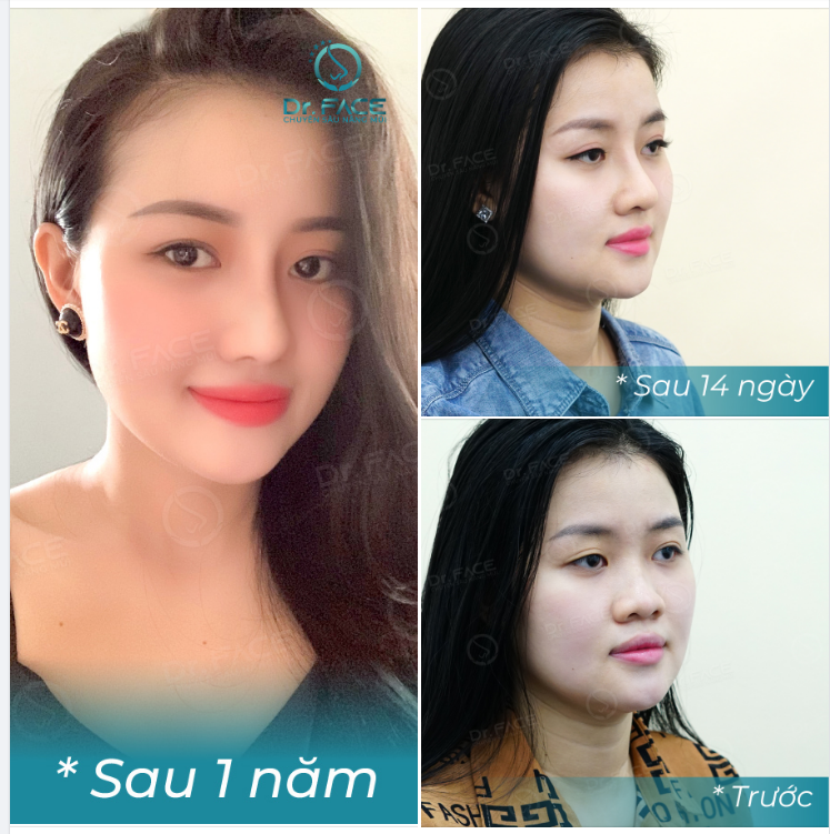 Chẳng tìm đâu ra, một người như thế. Môi cười xinh như hoa đáng yêu, thật thà..!