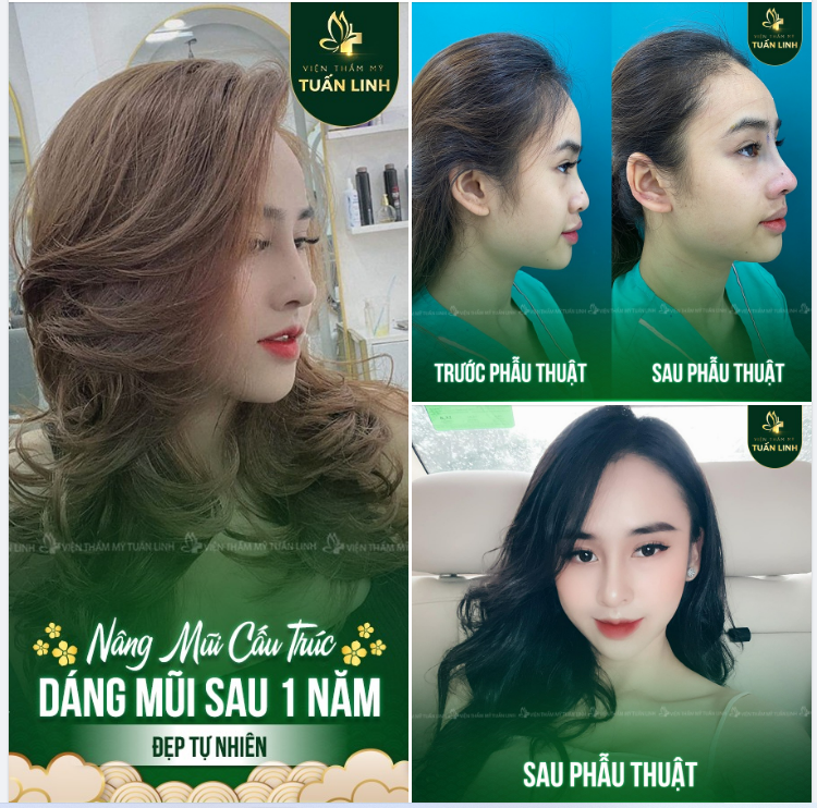 NÂNG MŨI CAO XINH - RINH NGAY TÀI LỘC